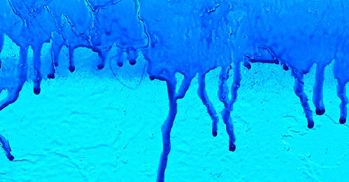 4137 02830 dye drips web