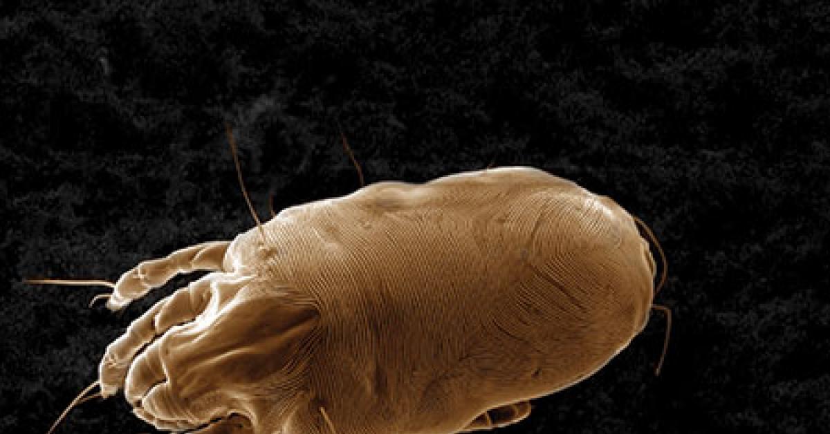 hohenstein institute milbe mikroskop dust mite magnified 450fach web