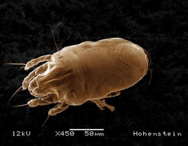 hohenstein institute milbe mikroskop dust mite magnified 450fach web